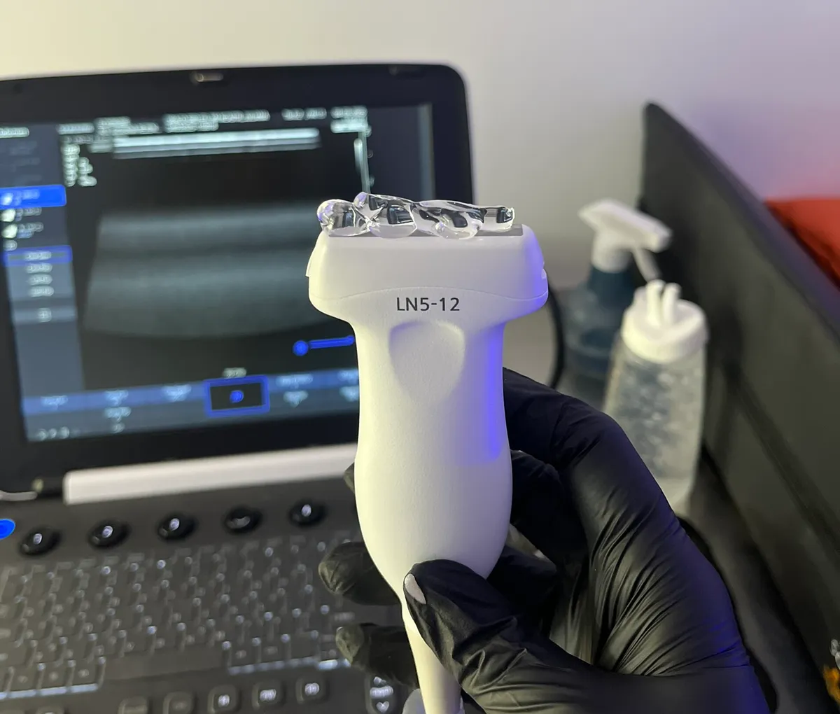 Transdutor de ultrassom de última geração usado nos atendimentos Ecoprobe